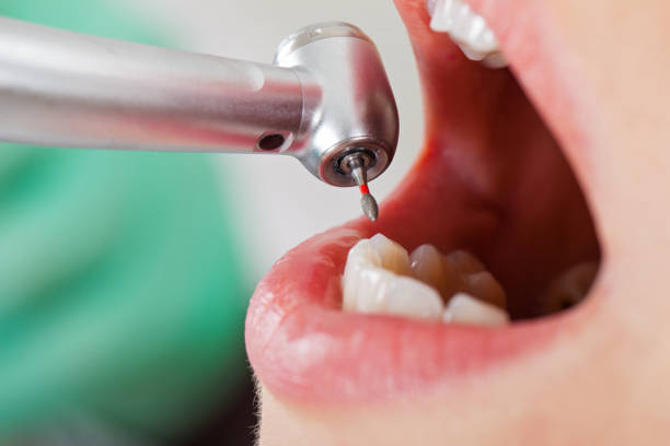 Best Broken or Cracked Tooth Emergency Dentist in Golden Grove, SC